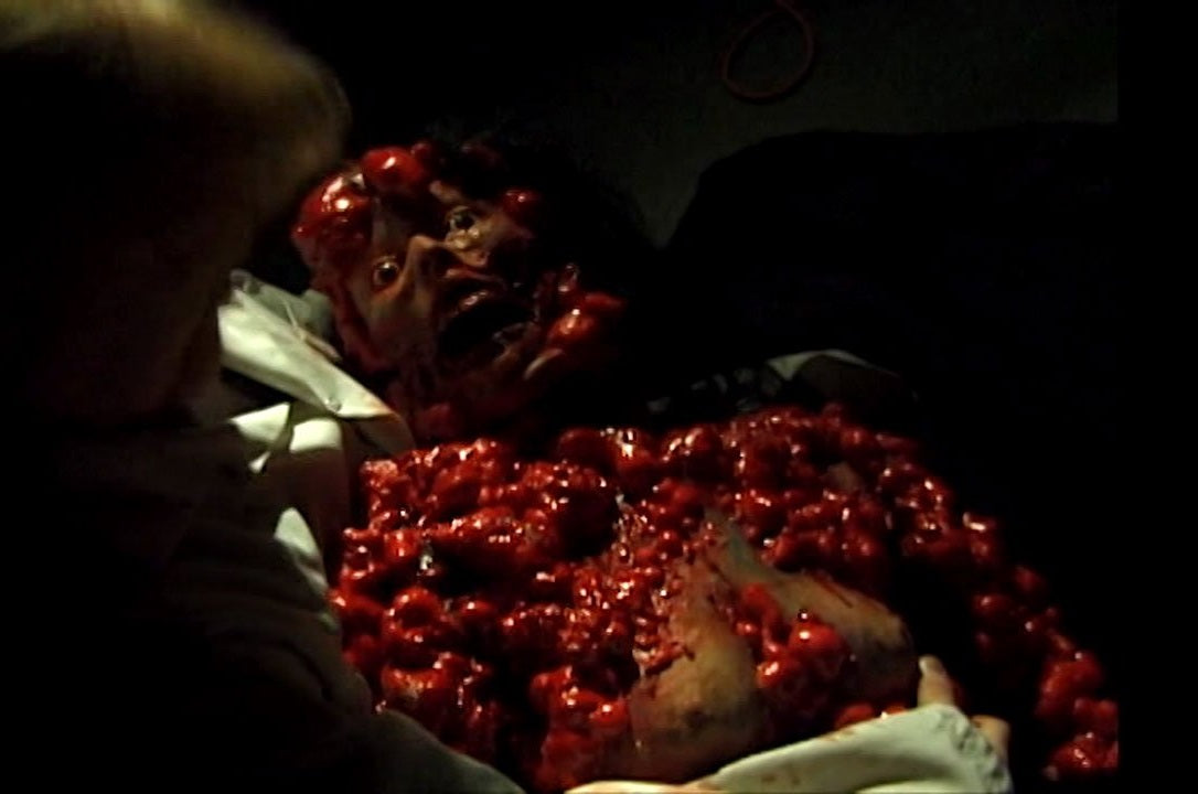 Fetus (DVD)